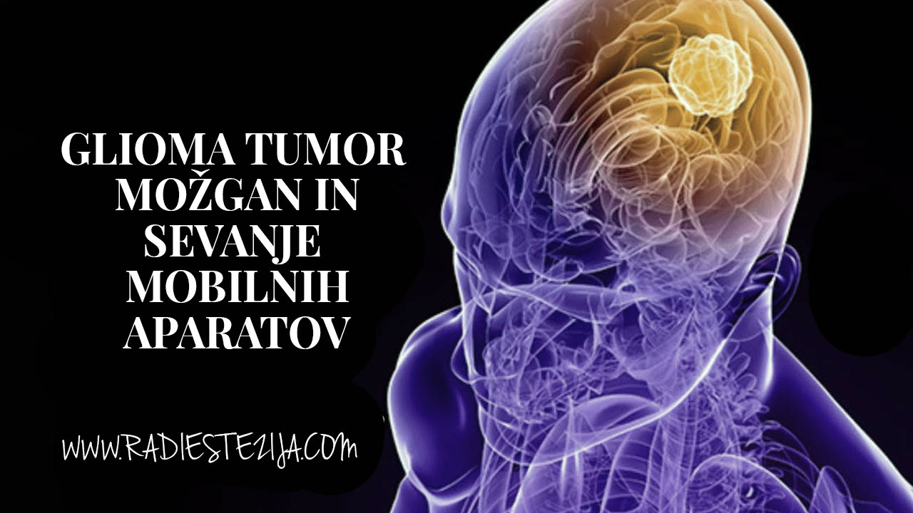 glioma-tumor-in-sevanje-povezava